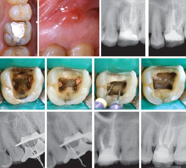 Dental X-ray examination